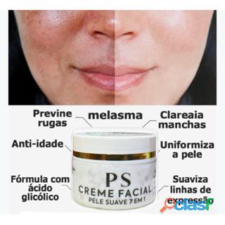 Melasma e Manchas